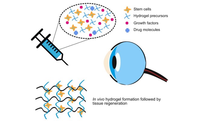 Decellularized corneal matrix hydrogel-based injectable hydrogel ? a candidate f