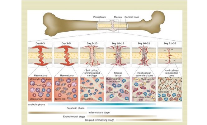 Bone graft substitutes for segmental defects in long bones