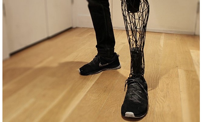 Affordable Personalized 3D Printed Lower Limb Prosthesis